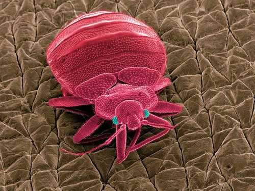 怎么消滅床虱？